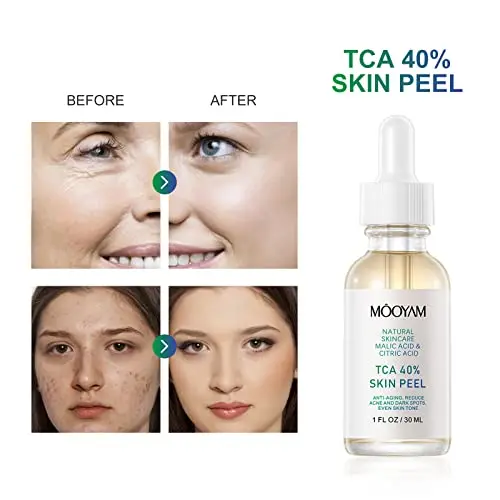 Skin Whitening Serum with Malic Acid and Citric Acid Peeling Solution Face Exfoliator for Face